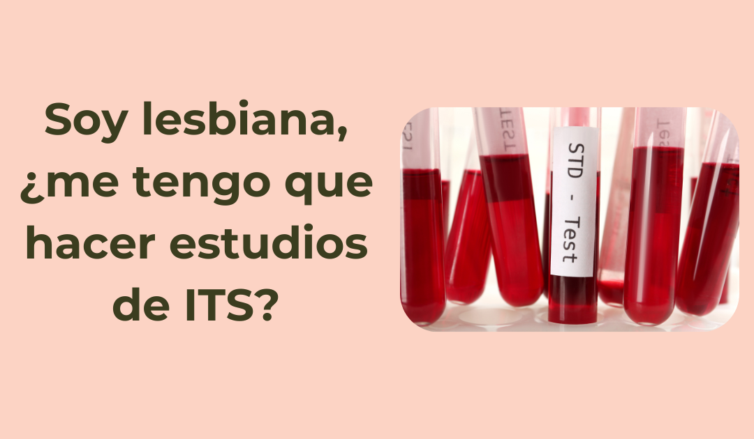 Soy lesbiana, ¿me tengo que hacer estudios de ITS? Salud sexual en Caballito, CABA