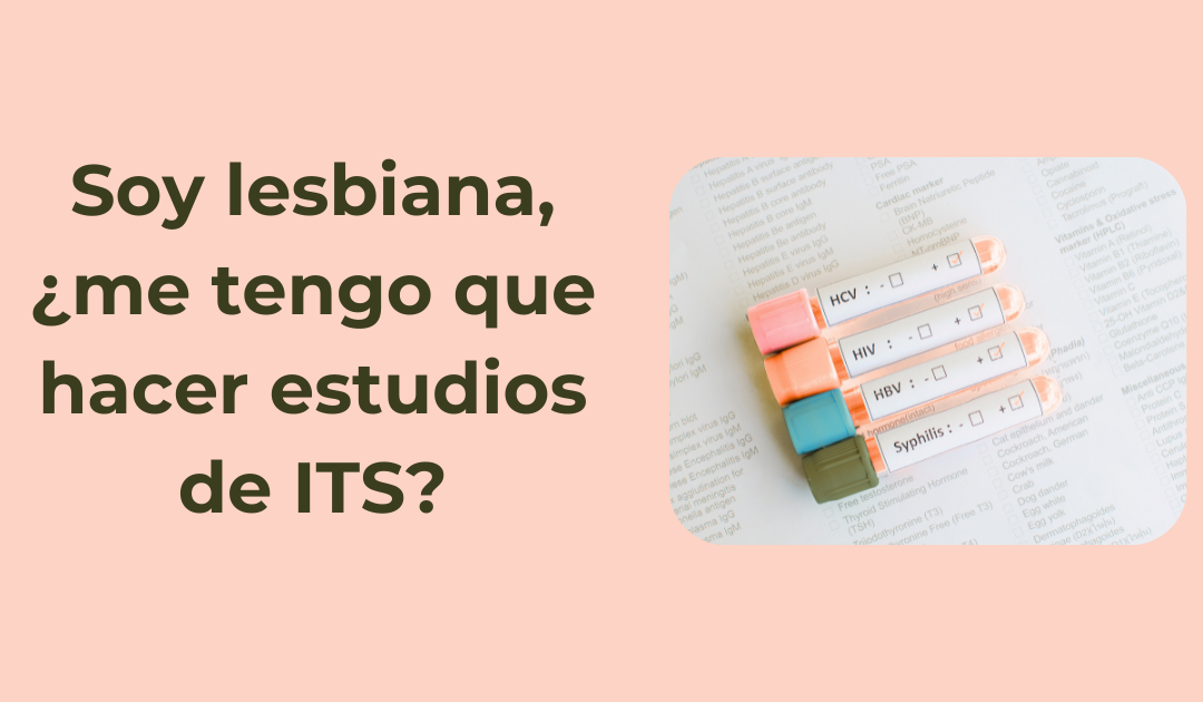 Soy lesbiana, ¿me tengo que hacer estudios de ITS? Salud sexual en Caballito, CABA